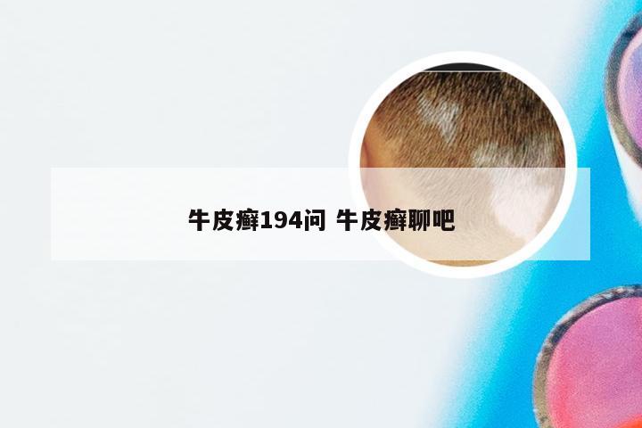 牛皮癣194问 牛皮癣聊吧