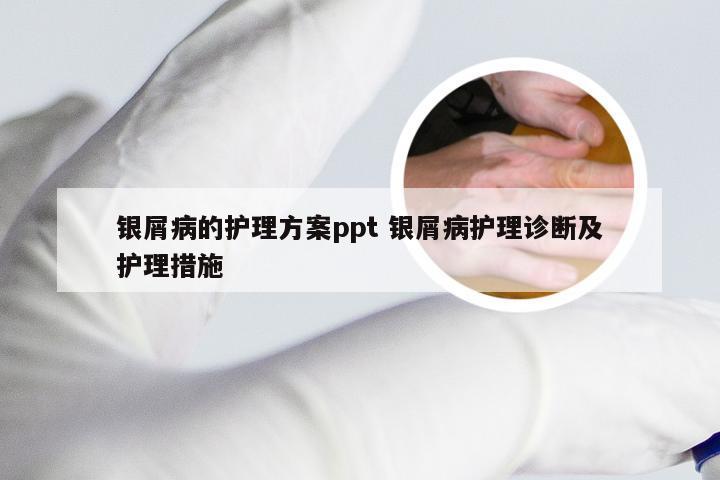 银屑病的护理方案ppt 银屑病护理诊断及护理措施