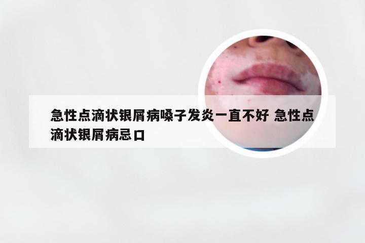 急性点滴状银屑病嗓子发炎一直不好 急性点滴状银屑病忌口