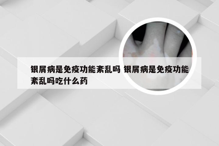 银屑病是免疫功能紊乱吗 银屑病是免疫功能紊乱吗吃什么药