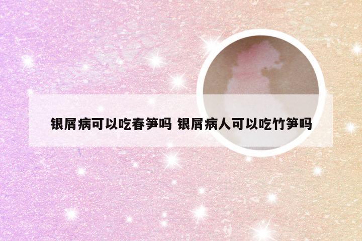 银屑病可以吃春笋吗 银屑病人可以吃竹笋吗