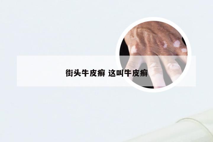 街头牛皮癣 这叫牛皮癣
