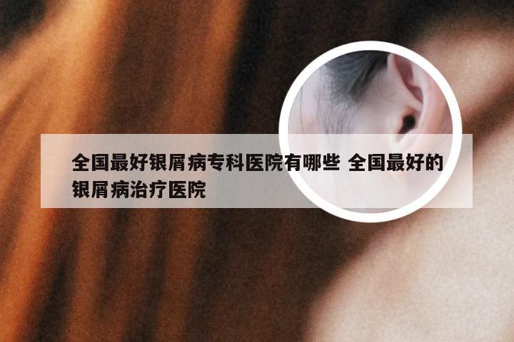 全国最好银屑病专科医院有哪些 全国最好的银屑病治疗医院