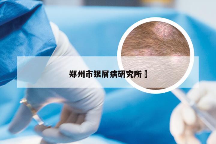 郑州市银屑病研究所 