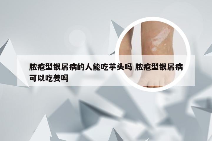 脓疱型银屑病的人能吃芋头吗 脓疱型银屑病可以吃姜吗