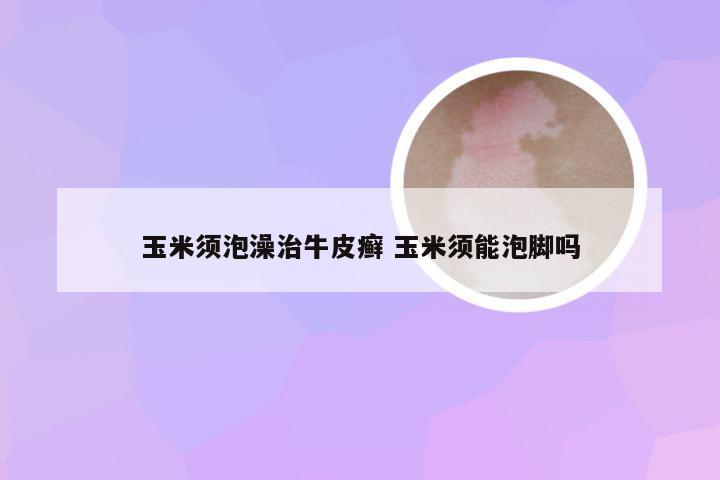 玉米须泡澡治牛皮癣 玉米须能泡脚吗
