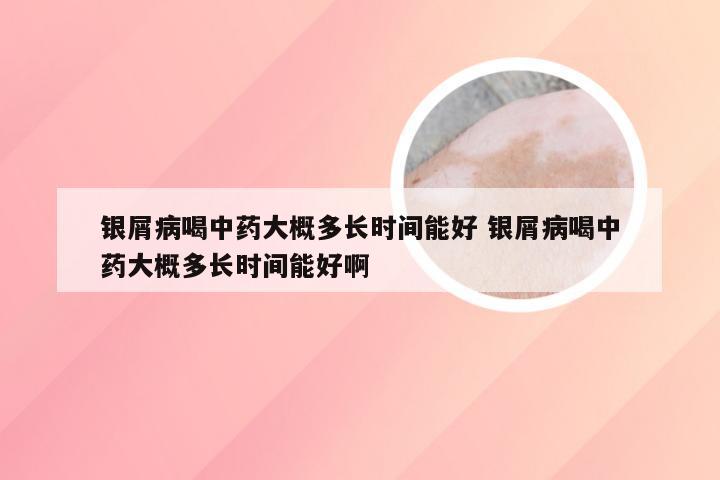 银屑病喝中药大概多长时间能好 银屑病喝中药大概多长时间能好啊