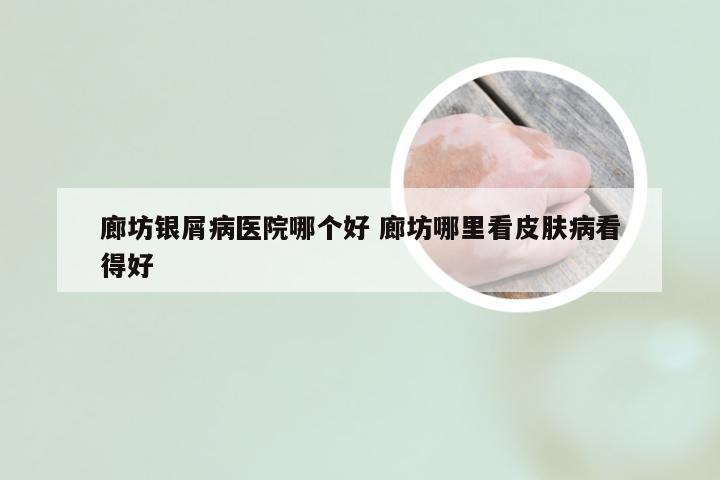 廊坊银屑病医院哪个好 廊坊哪里看皮肤病看得好