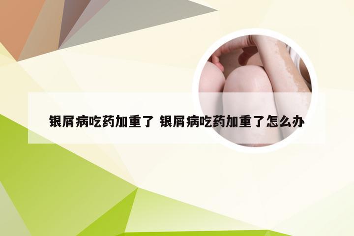 银屑病吃药加重了 银屑病吃药加重了怎么办