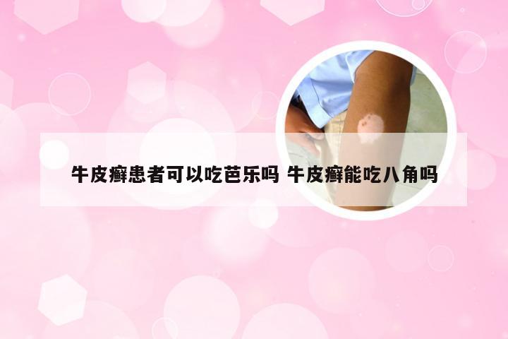 牛皮癣患者可以吃芭乐吗 牛皮癣能吃八角吗