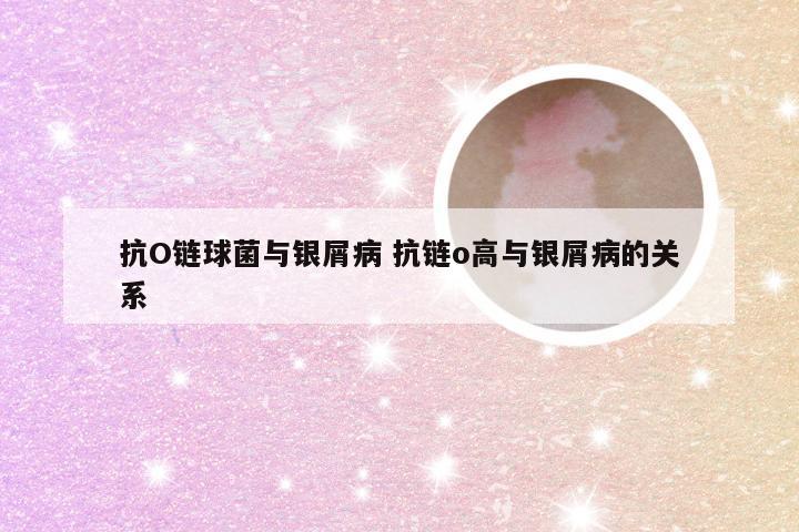 抗O链球菌与银屑病 抗链o高与银屑病的关系