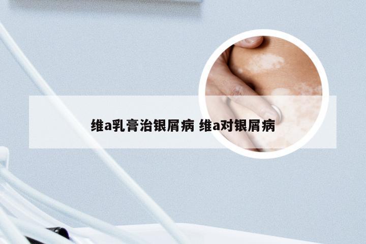 维a乳膏治银屑病 维a对银屑病