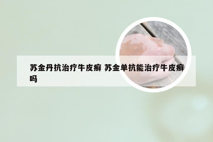 苏金丹抗治疗牛皮癣 苏金单抗能治疗牛皮癣吗