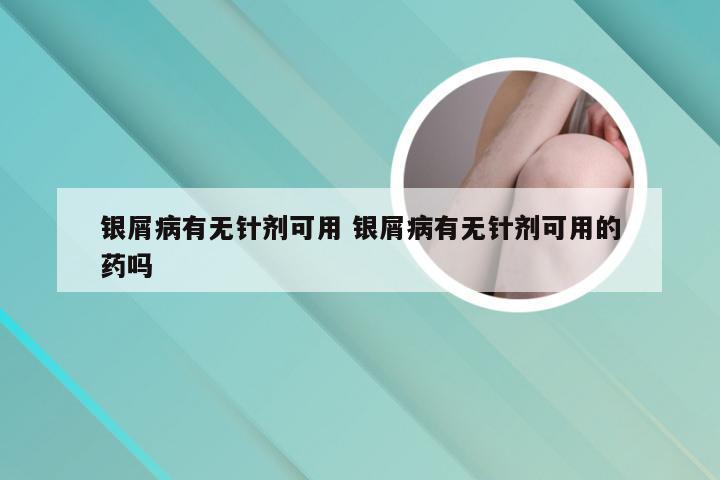 银屑病有无针剂可用 银屑病有无针剂可用的药吗