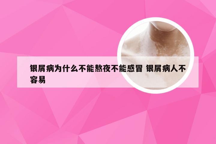 银屑病为什么不能熬夜不能感冒 银屑病人不容易