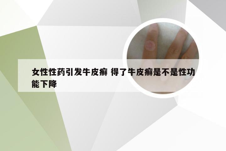 女性性药引发牛皮癣 得了牛皮癣是不是性功能下降
