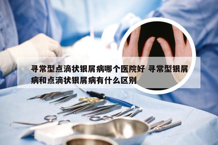 寻常型点滴状银屑病哪个医院好 寻常型银屑病和点滴状银屑病有什么区别