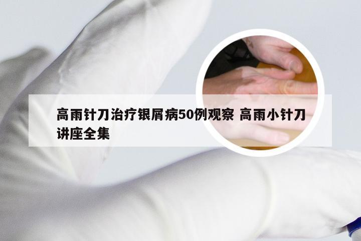 高雨针刀治疗银屑病50例观察 高雨小针刀讲座全集