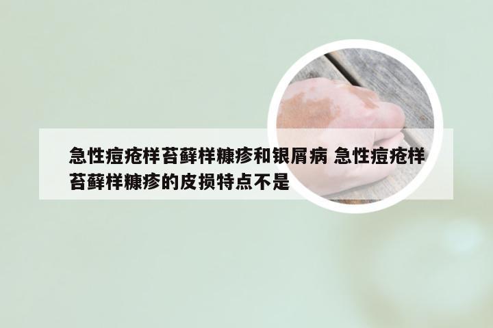 急性痘疮样苔藓样糠疹和银屑病 急性痘疮样苔藓样糠疹的皮损特点不是