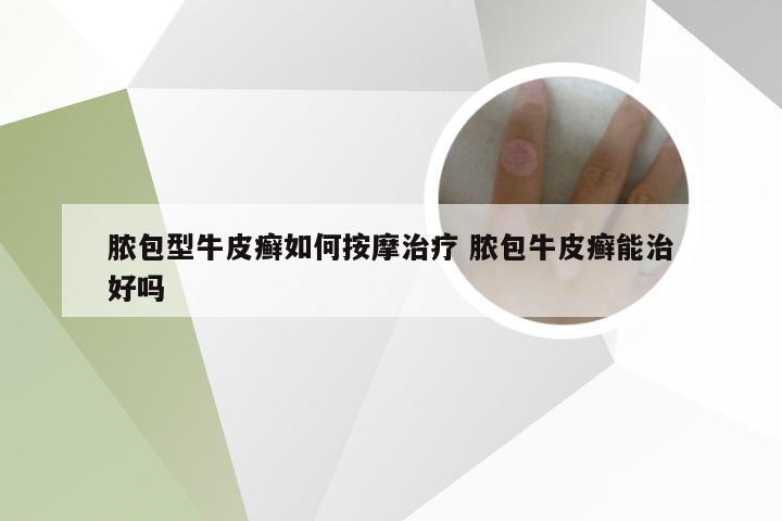 脓包型牛皮癣如何按摩治疗 脓包牛皮癣能治好吗