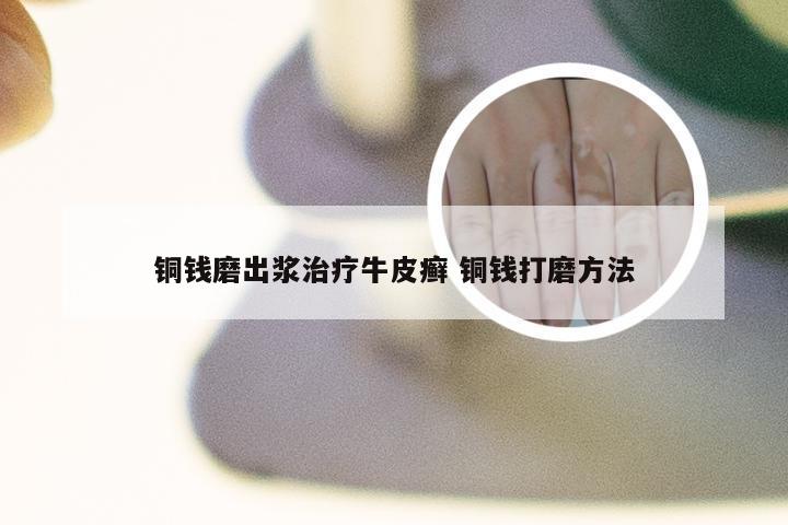 铜钱磨出浆治疗牛皮癣 铜钱打磨方法