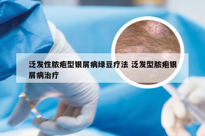 泛发性脓疱型银屑病绿豆疗法 泛发型脓疱银屑病治疗