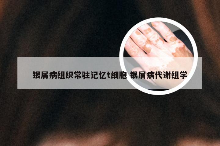 银屑病组织常驻记忆t细胞 银屑病代谢组学