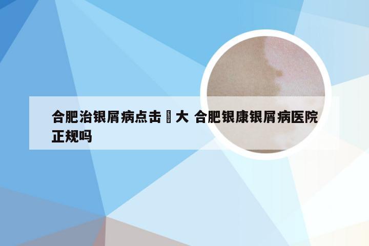 合肥治银屑病点击軍大 合肥银康银屑病医院正规吗