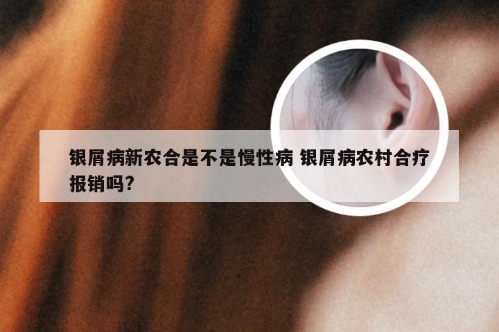 银屑病新农合是不是慢性病 银屑病农村合疗报销吗?