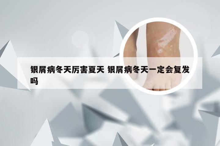 银屑病冬天厉害夏天 银屑病冬天一定会复发吗