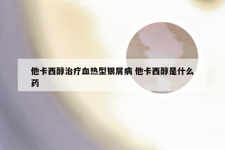 他卡西醇治疗血热型银屑病 他卡西醇是什么药
