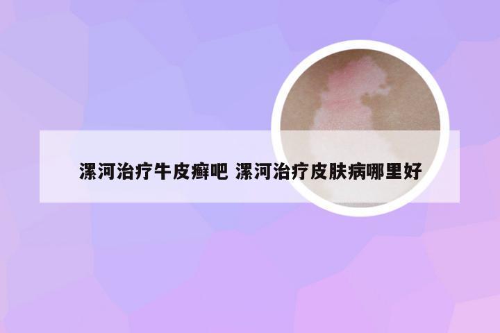 漯河治疗牛皮癣吧 漯河治疗皮肤病哪里好