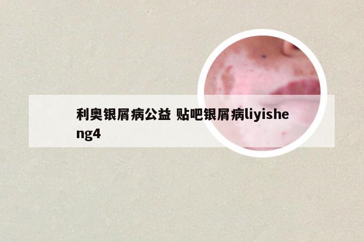 利奥银屑病公益 贴吧银屑病liyisheng4