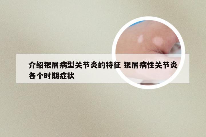介绍银屑病型关节炎的特征 银屑病性关节炎各个时期症状