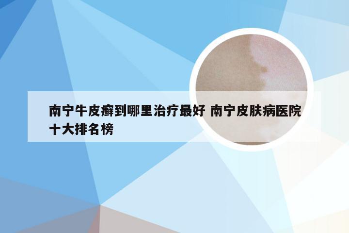 南宁牛皮癣到哪里治疗最好 南宁皮肤病医院十大排名榜