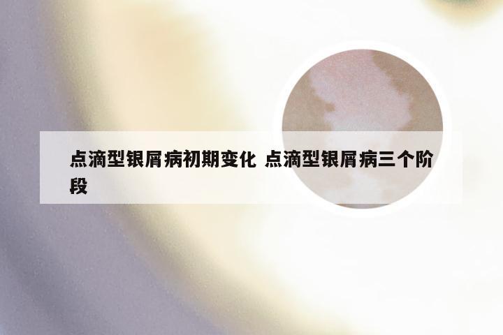 点滴型银屑病初期变化 点滴型银屑病三个阶段