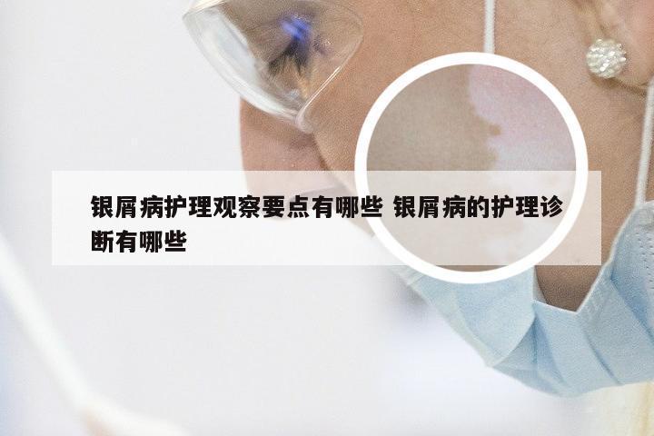 银屑病护理观察要点有哪些 银屑病的护理诊断有哪些