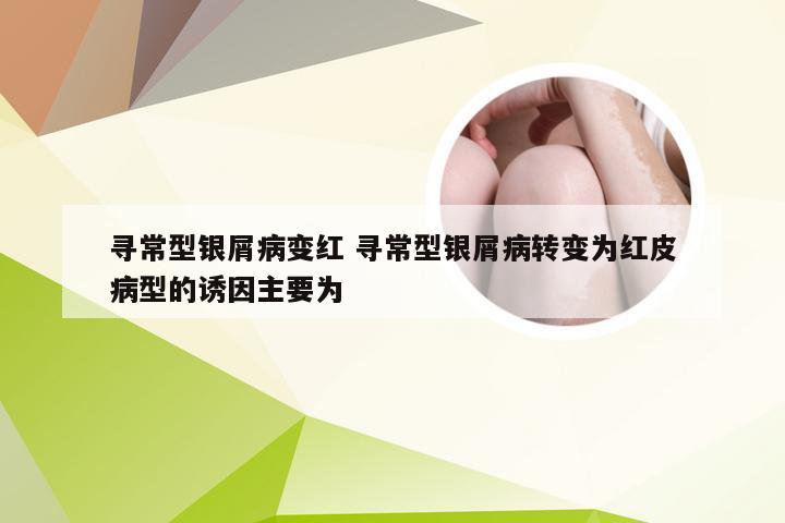 寻常型银屑病变红 寻常型银屑病转变为红皮病型的诱因主要为