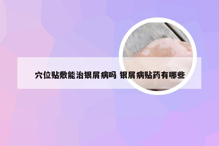 穴位贴敷能治银屑病吗 银屑病贴药有哪些