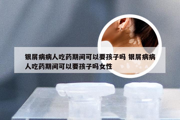 银屑病病人吃药期间可以要孩子吗 银屑病病人吃药期间可以要孩子吗女性