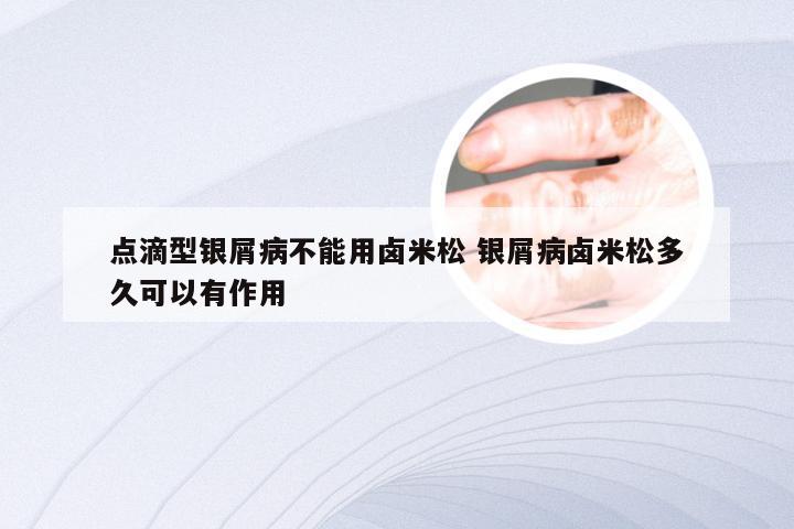 点滴型银屑病不能用卤米松 银屑病卤米松多久可以有作用