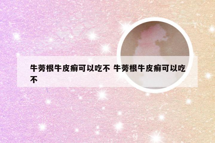 牛蒡根牛皮癣可以吃不 牛蒡根牛皮癣可以吃不