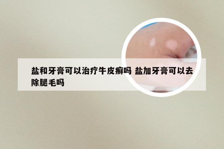 盐和牙膏可以治疗牛皮癣吗 盐加牙膏可以去除腿毛吗