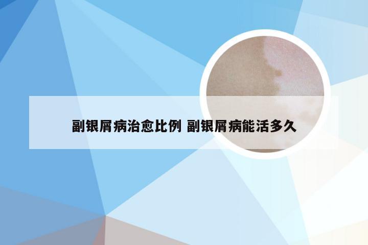 副银屑病治愈比例 副银屑病能活多久
