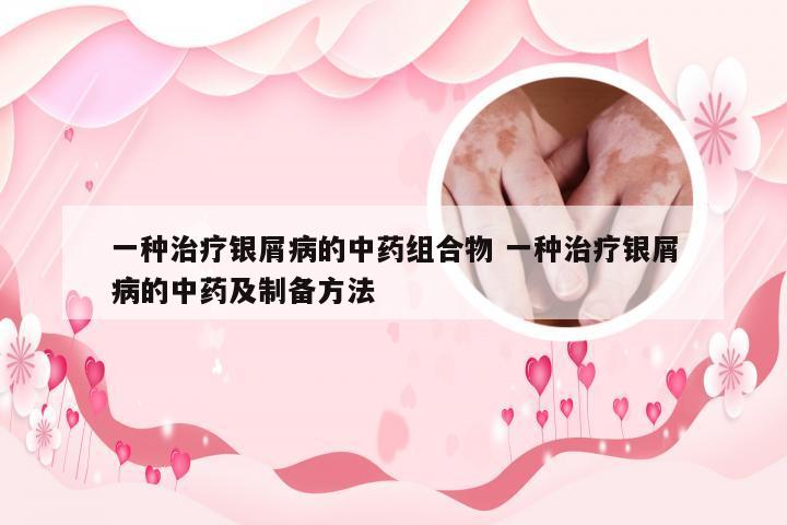一种治疗银屑病的中药组合物 一种治疗银屑病的中药及制备方法