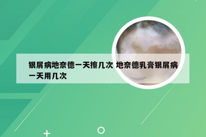 银屑病地奈德一天擦几次 地奈德乳膏银屑病一天用几次