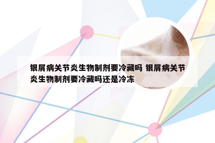 银屑病关节炎生物制剂要冷藏吗 银屑病关节炎生物制剂要冷藏吗还是冷冻