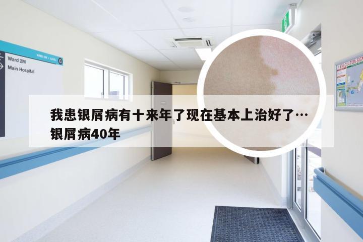 我患银屑病有十来年了现在基本上治好了… 银屑病40年