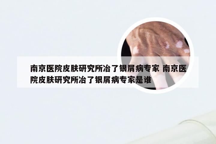 南京医院皮肤研究所冶了银屑病专家 南京医院皮肤研究所冶了银屑病专家是谁