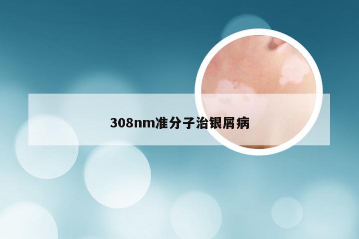 308nm准分子治银屑病